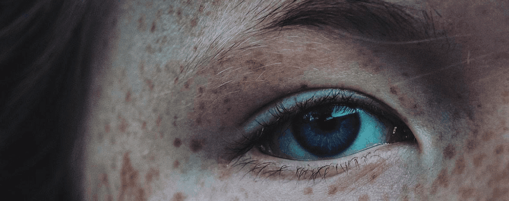Moles and Their Significance