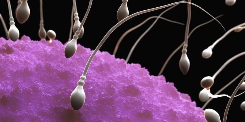 Top Reasons for Azoospermia