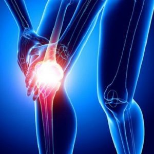 Arthritis Treatment in Medical Astrology