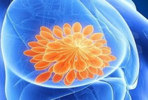 Breast Cancer Treatment In Medical Astrology