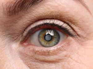 Cataract Treatment In Medical Astrology