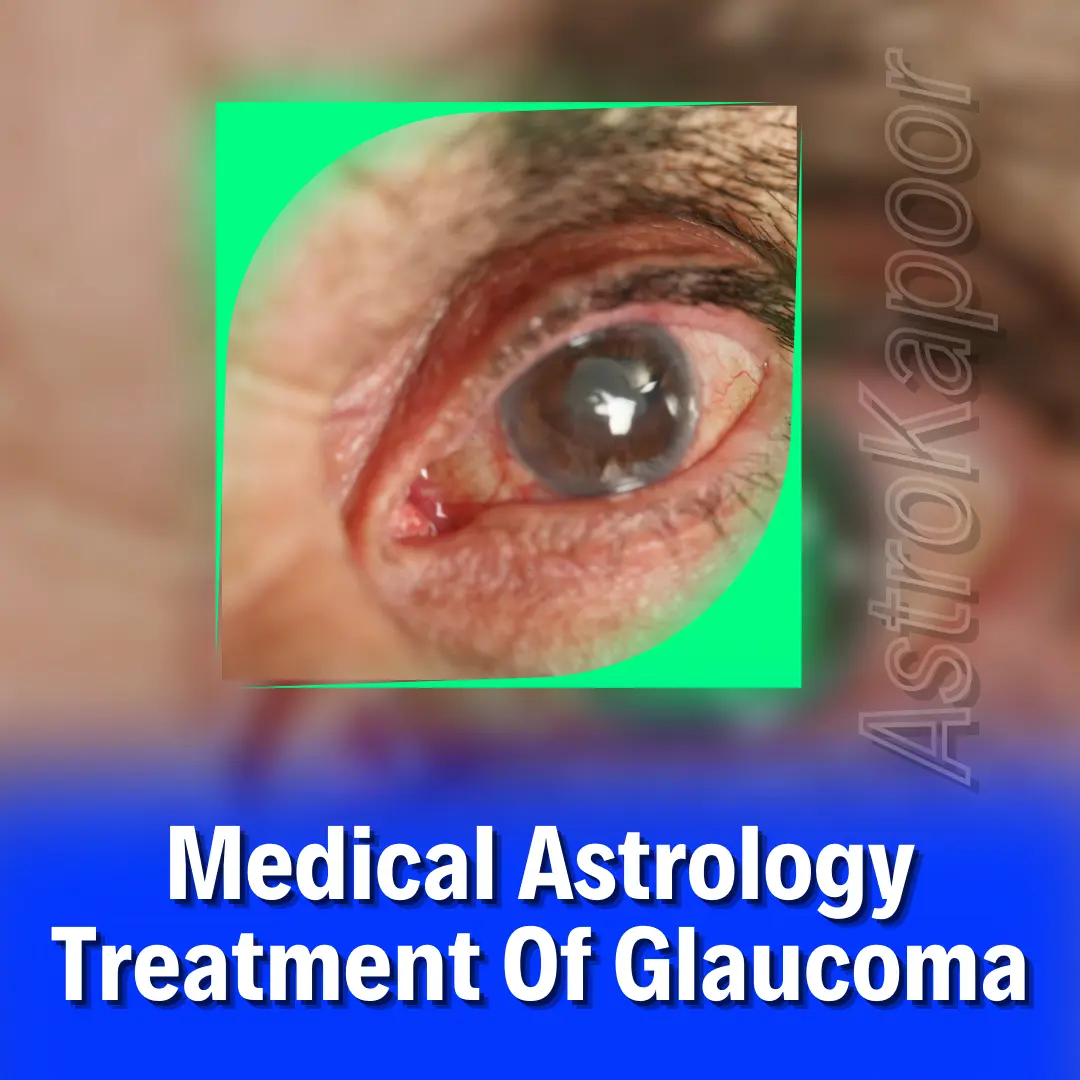 Medical Astrology Treatment Of Glaucoma Image