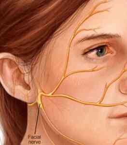 Medical Astrology Treatment of Bell's Palsy