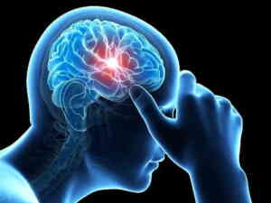Migraine Treatment in Medical Astrology