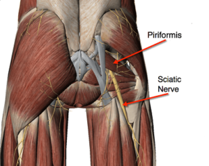 Sciatica Treatment In Medical Astrology