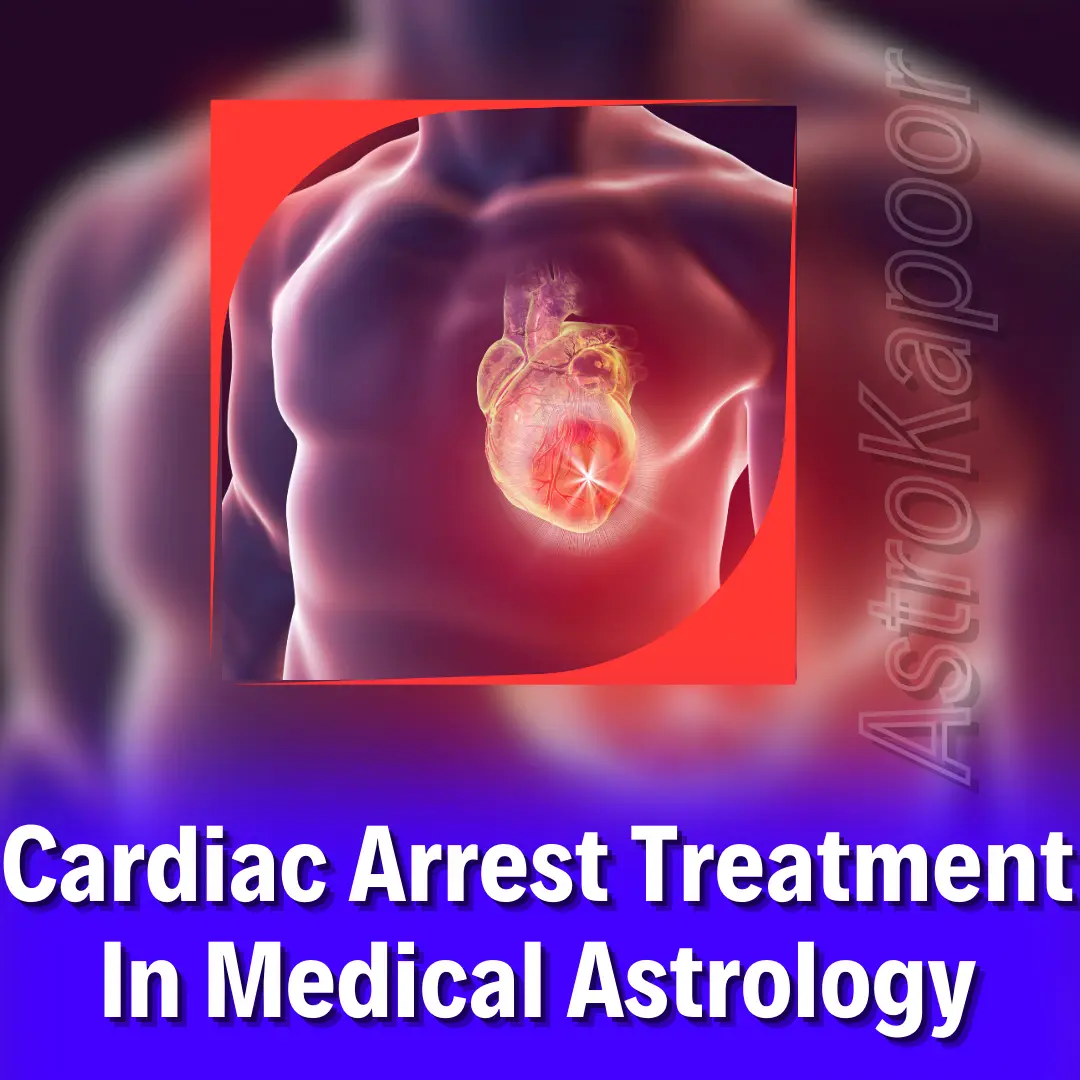 Cardiac Arrest Treatment In Medical Astrology Image