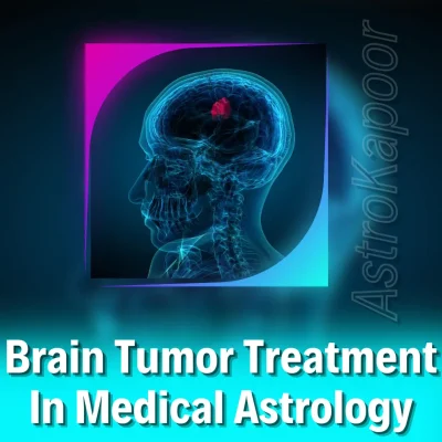 Brain Tumor Treatment In Medical Astrology Image