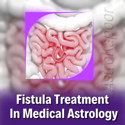 Fistula Treatment In Medical Astrology Image