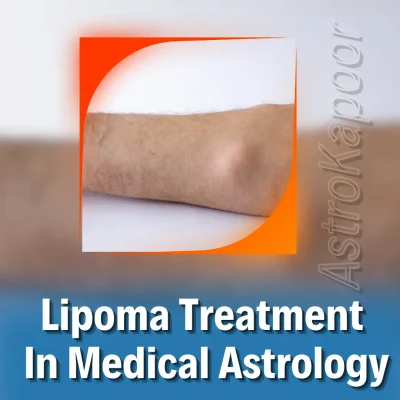 Lipoma Treatment In Medical Astrology Image
