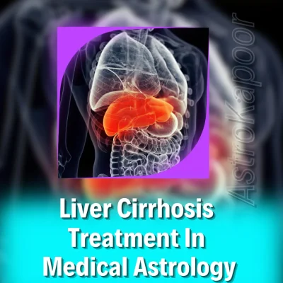 Liver Cirrhosis Treatment In Medical Astrology Image