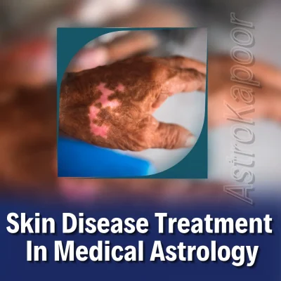 Skin Disease Treatment In Medical Astrology Image