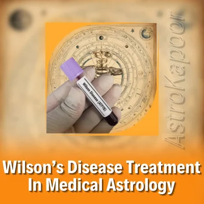 Wilson’s Disease Treatment In Medical Astrology Image